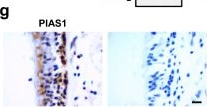Fig.6.G showing Immunohistochemistry from the publication: SUMOylation of Rho-associated protein kinase 2 induces goblet cell metaplasia in allergic airways.