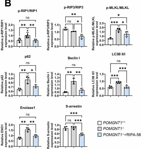 Fig.8.B showing Flow cytometry/Cell sorting in a Mus musculus (House mouse) sample from the publication: Glycosylation-driven necroptosis in retinal degeneration: dual rescue by AAV8 gene therapy and RIPK1 inhibition.