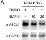 Fig.3.A showing Western Blotting in a Homo sapiens (Human) sample from the publication: Therapeutic targeting of BAP1/ASXL3 sub-complex in ASCL1-dependent small cell lung cancer.