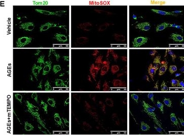 Fig.5.E showing Immunocytochemistry-immunofluorescence in a Mus musculus (House mouse) sample from the publication: Mitochondrial oxidative stress promotes the accumulation of advanced glycation end products.