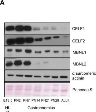 Fig.6.A showing Western Blotting in a Mus musculus (House mouse) sample from the publication: Extensive alternative splicing transitions during postnatal skeletal muscle development are required for calcium handling functions.