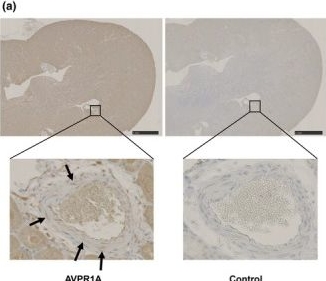 Fig.1.A showing Immunohistochemistry in a Mus musculus (House mouse) sample from the publication: Roles of vasopressin in renal blood flow and vascular resistance in male mice after treadmill running: A mechanism for ALPE.