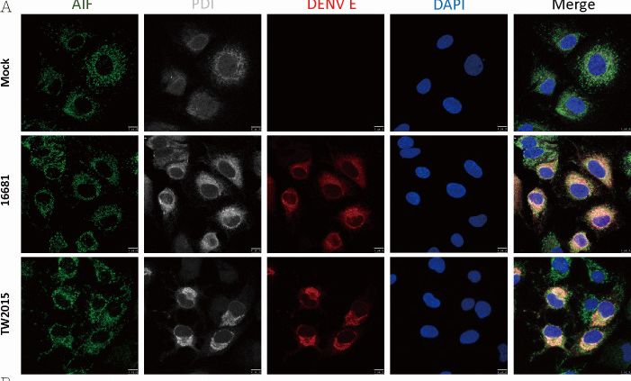 Fig.4.A showing Immunocytochemistry-immunofluorescence from the publication: Pathogenic dengue virus TW2015 strain infection triggers anaerobic glycolysis and enhances mortality in diabetic mice.