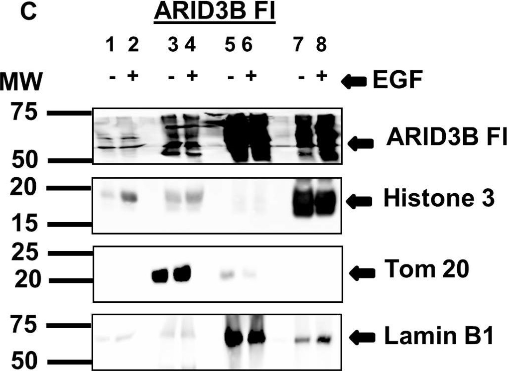 Fig.5.C showing Western Blotting in a Homo sapiens (Human) sample from the publication: ARID3B induces tumor necrosis factor alpha mediated apoptosis while a novel ARID3B splice form does not induce cell death.