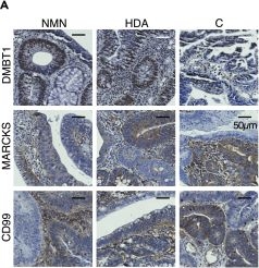 Fig.5.A showing Immunohistochemistry in a Homo sapiens (Human) sample from the publication: Spatial characterization and stratification of colorectal adenomas by deep visual proteomics.