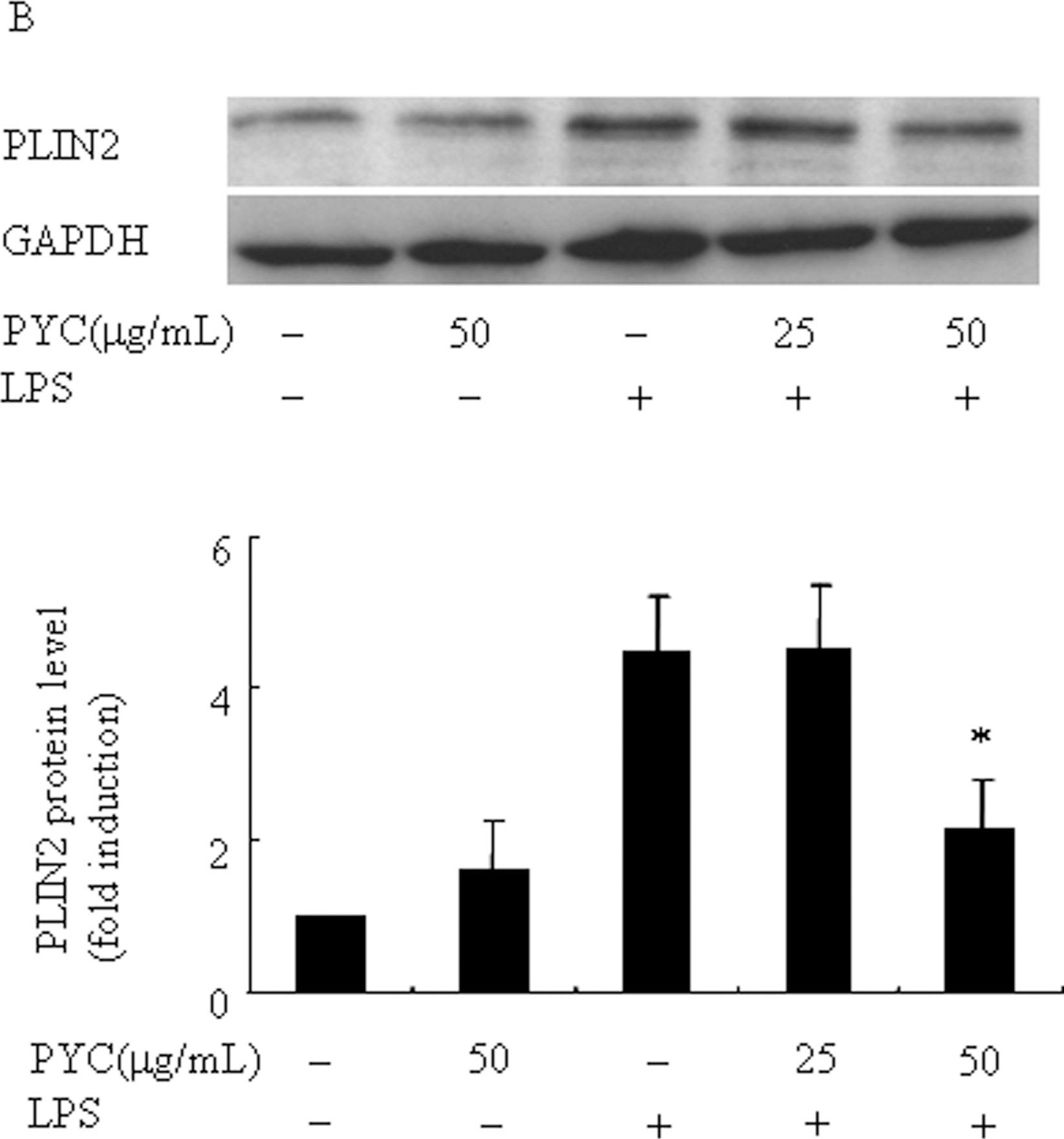 Pycnogenol Attenuates the Release of Proinflammatory Cytokines and Expression of Perilipin 2 in Lipopolysaccharide-Stimulated Microglia in Part via Inhibition of NF-κB and AP-1 Activation.