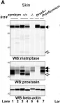 Fig.4.A showing Simple Western - Size in a Mus musculus (House mouse) sample from the publication: Matriptase zymogen supports epithelial development, homeostasis and regeneration.