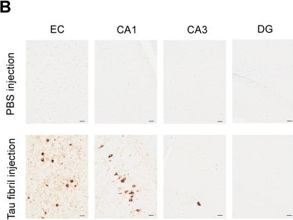 Fig.1.B showing Immunohistochemistry in a Homo sapiens (Human) sample from the publication: Chronic Neuronal Hyperexcitation Exacerbates Tau Propagation in a Mouse Model of Tauopathy.