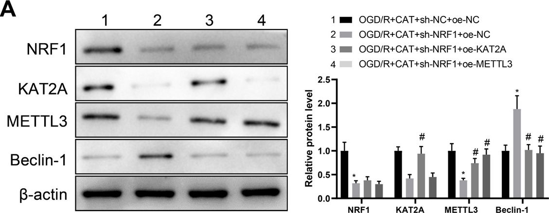 Fig.6.A showing Western Blotting from the publication: A study on the mechanism of Beclin-1 m6A modification mediated by catalpol in protection against neuronal injury and autophagy following cerebral ischemia.
