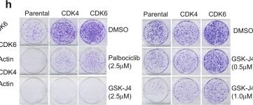 Fig.6.H from the publication: KDM6B promotes activation of the oncogenic CDK4/6-pRB-E2F pathway by maintaining enhancer activity in MYCN-amplified neuroblastoma.