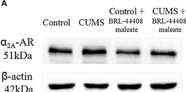 Fig.4.A showing Western Blotting in a Rattus norvegicus (Rat) sample from the publication: Effects of α2A Adrenoceptors on Norepinephrine Secretion from the Locus Coeruleus during Chronic Stress-Induced Depression.