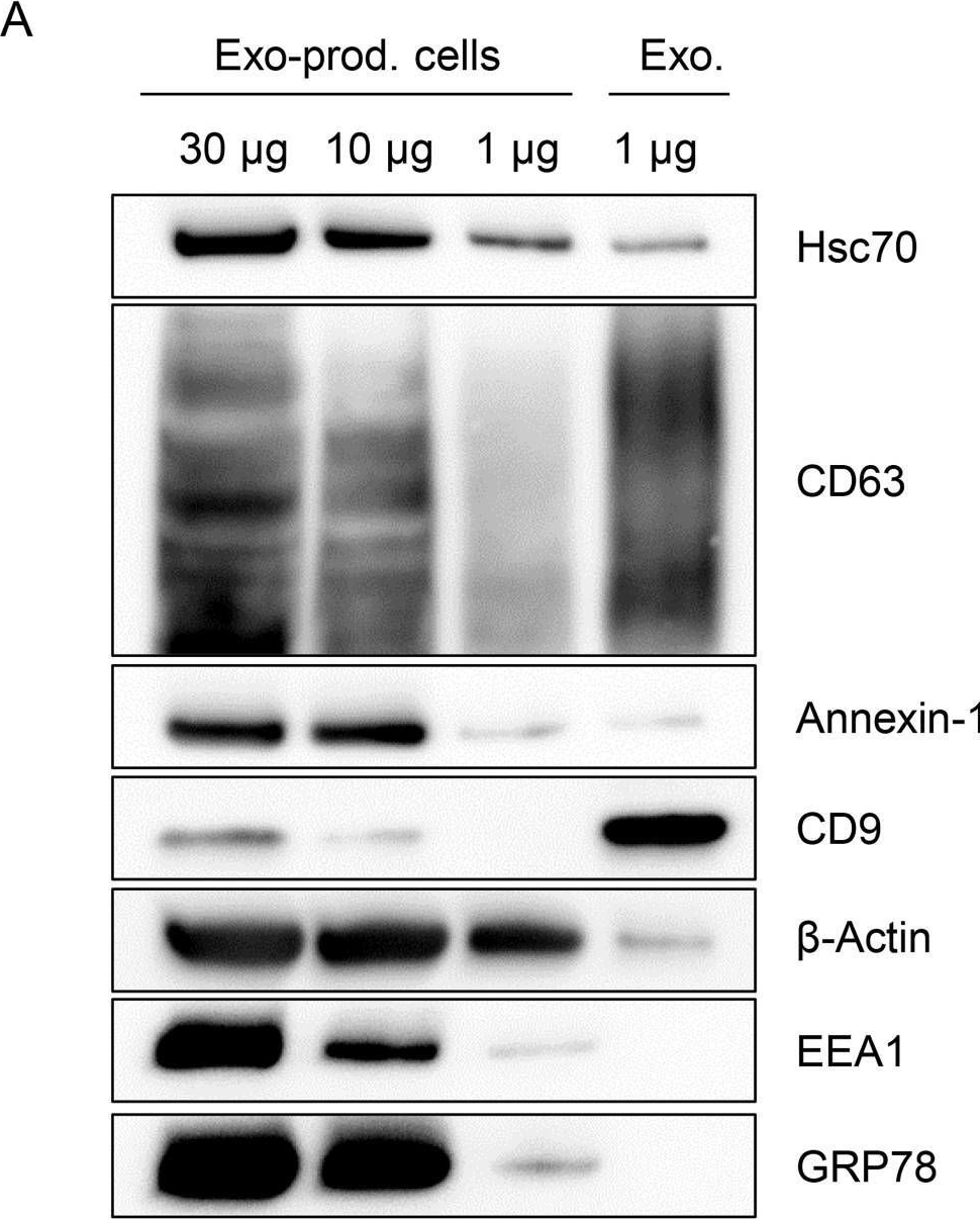 Fig.7.A showing Western Blotting from the publication: Dependence of intracellular and exosomal microRNAs on viral E6/E7 oncogene expression in HPV-positive tumor cells.