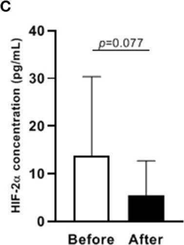 Fig.2.C showing Enzyme-linked immunosorbent assay from the publication: Decreased plasma levels of PDGF-BB, VEGF-A, and HIF-2α in preterm infants after ibuprofen treatment.