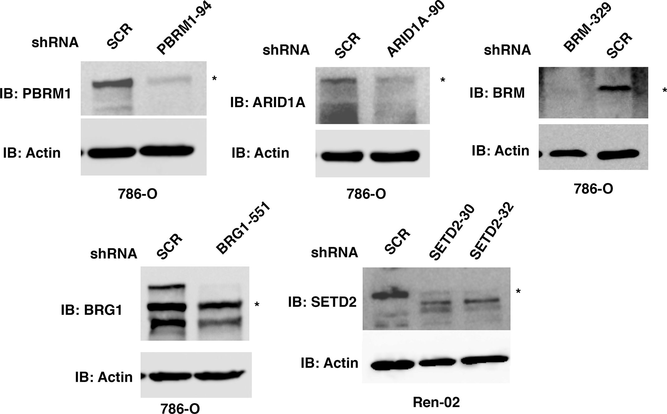Fig.1.A showing Western Blotting in a Homo sapiens (Human) sample from the publication: Immunohistochemistry Successfully Uncovers Intratumoral Heterogeneity and Widespread Co-Losses of Chromatin Regulators in Clear Cell Renal Cell Carcinoma.