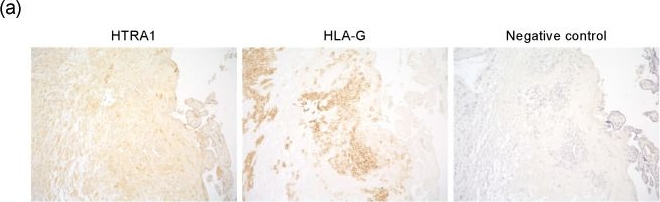 Fig.2.A showing Immunohistochemistry from the publication: Alpha-1 Antitrypsin-Induced Endoplasmic Reticulum Stress Promotes Invasion by Extravillous Trophoblasts.