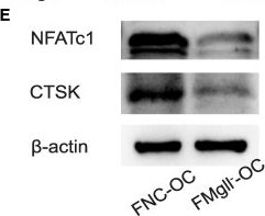Fig.3.E showing Western Blotting in a Mus musculus (House mouse) sample from the publication: Inhibiting hepatocytes MAGL alleviates osteoporosis caused by high-fat diet-induced liver fibrosis in male mice.