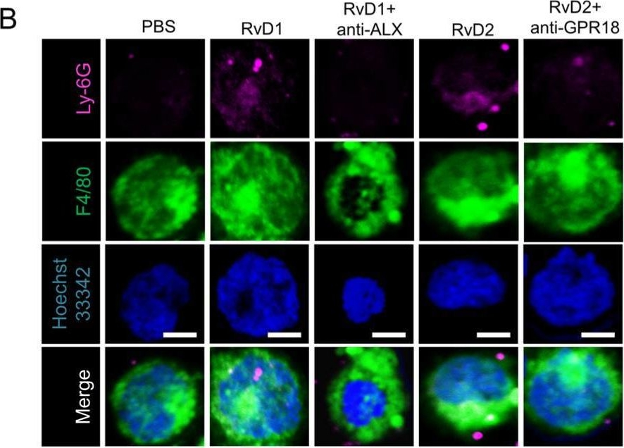 Fig.4.B showing Immunocytochemistry-immunofluorescence in a Homo sapiens (Human) sample from the publication: Lung Inflammation Resolution by RvD1 and RvD2 in a Receptor-Dependent Manner.