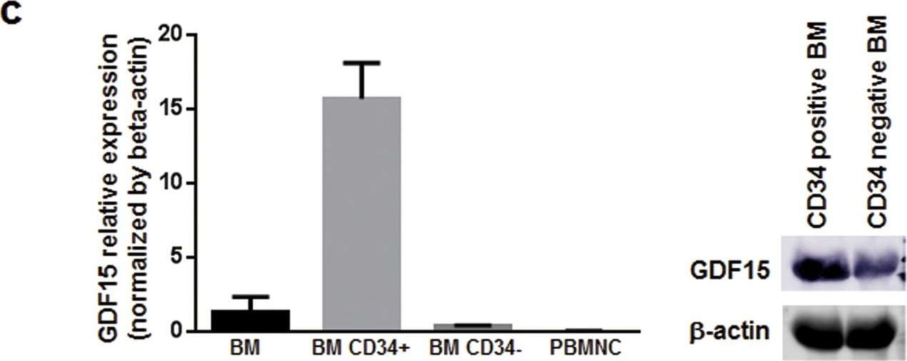 Fig.3.C showing Western Blotting in a Mus musculus (House mouse) sample from the publication: Increased plasma VEGF levels following ischemic preconditioning are associated with downregulation of miRNA-762 and miR-3072-5p.