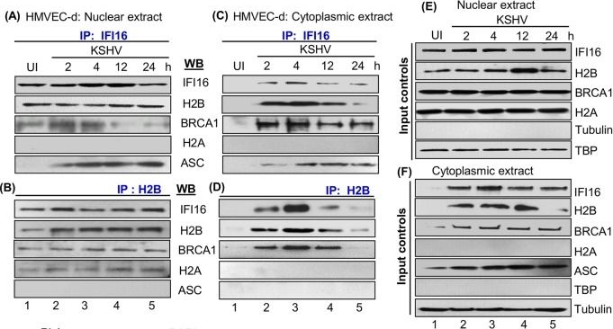 Fig.2.A,B,C,D,E,F showing Western Blotting in a Homo sapiens (Human) sample from the publication: Histone H2B-IFI16 Recognition of Nuclear Herpesviral Genome Induces Cytoplasmic Interferon-β Responses.