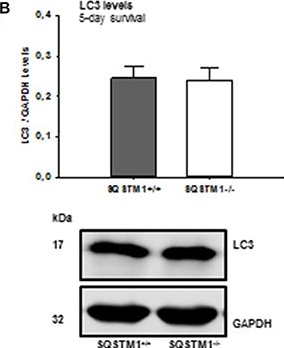 Sequestosome 1 Deficiency Delays, but Does Not Prevent Brain Damage Formation Following Acute Brain Injury in Adult Mice.