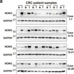 Fig.1.A showing Western Blotting from the publication: PRMT1 enhances oncogenic arginine methylation of NONO in colorectal cancer.