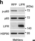 Fig.3.H showing Western Blotting from the publication: A targetable LIFR-NF-κB-LCN2 axis controls liver tumorigenesis and vulnerability to ferroptosis.