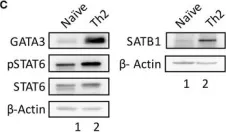 Fig.1.C showing Western Blotting in a Homo sapiens (Human) sample from the publication: NF-κB Signaling and IL-4 Signaling Regulate SATB1 Expression via Alternative Promoter Usage During Th2 Differentiation.