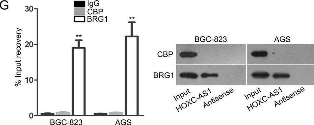 Fig.5.G showing Western Blotting from the publication: HOXC-AS1-MYC regulatory loop contributes to the growth and metastasis in gastric cancer.