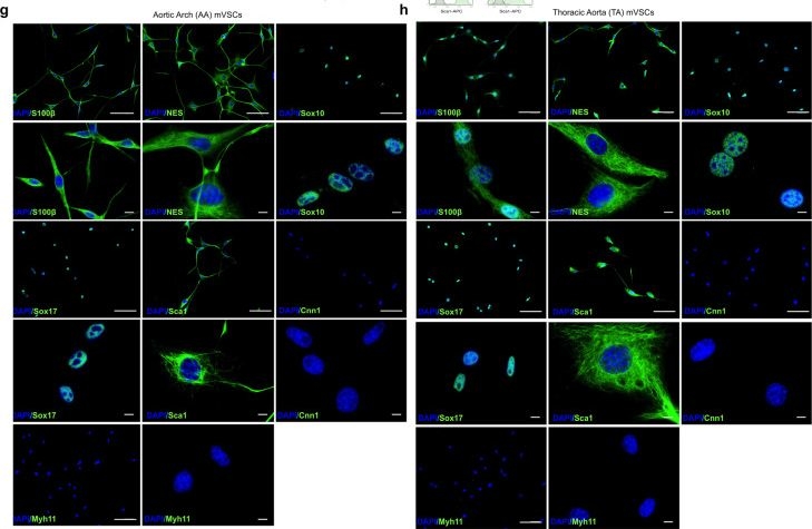 Fig.5.G showing Immunocytochemistry-immunofluorescence from the publication: The calcium binding protein S100β marks hedgehog-responsive resident vascular stem cells within vascular lesions.