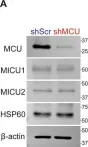 Fig.2.A showing Western Blotting from the publication: Mitochondrial calcium uptake regulates tumour progression in embryonal rhabdomyosarcoma.