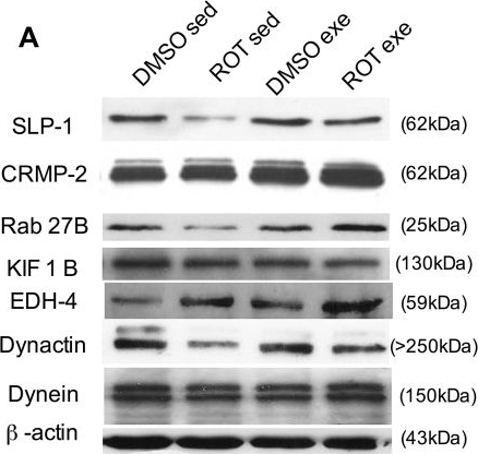 Fig.3.A showing Western Blotting in a Rattus norvegicus (Rat) sample from the publication: BDNF trafficking and signaling impairment during early neurodegeneration is prevented by moderate physical activity.