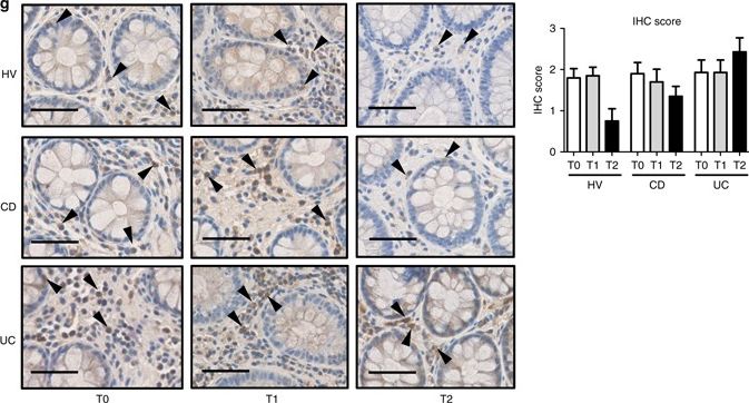 Hypoxia ameliorates intestinal inflammation through NLRP3/mTOR downregulation and autophagy activation.