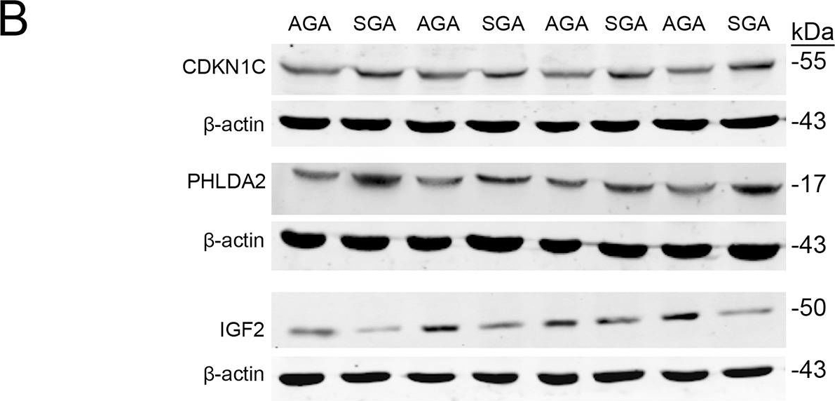 Fig.1.B showing Western Blotting in a Homo sapiens (Human) sample from the publication: Abundances of placental imprinted genes CDKN1C, PHLDA2 and IGF-2 are related to low birth weight and early catch-up growth in full-term infants born small for gestational age.
