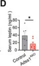Fig.4.D showing Enzyme-linked immunosorbent assay from the publication: Adenylosuccinate Synthase 1 Deficiency Improves Energy Metabolism by Promoting Adipose Tissue Re-esterification via Glycerol Kinase Upregulation.