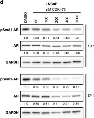 Fig.4.D showing Western Blotting in a Homo sapiens (Human) sample from the publication: CDK9 inhibition inhibits multiple oncogenic transcriptional and epigenetic pathways in prostate cancer.