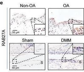 Fig.1.E showing Immunohistochemistry in a Mus musculus (House mouse) sample from the publication: Inflammatory Fibroblast-Like Synoviocyte-Derived Exosomes Aggravate Osteoarthritis via Enhancing Macrophage Glycolysis.