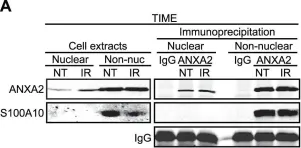 Fig.4.A showing Western Blotting in a Homo sapiens (Human) sample from the publication: Genotoxic agents promote the nuclear accumulation of annexin A2: role of annexin A2 in mitigating DNA damage.