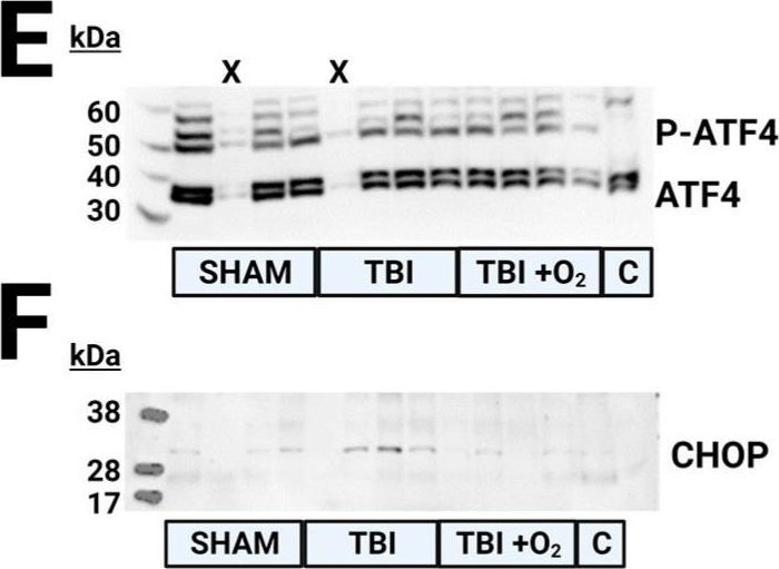 Chop Bioresponse Program CHOP antibodies - Antibody search engine - CiteAb