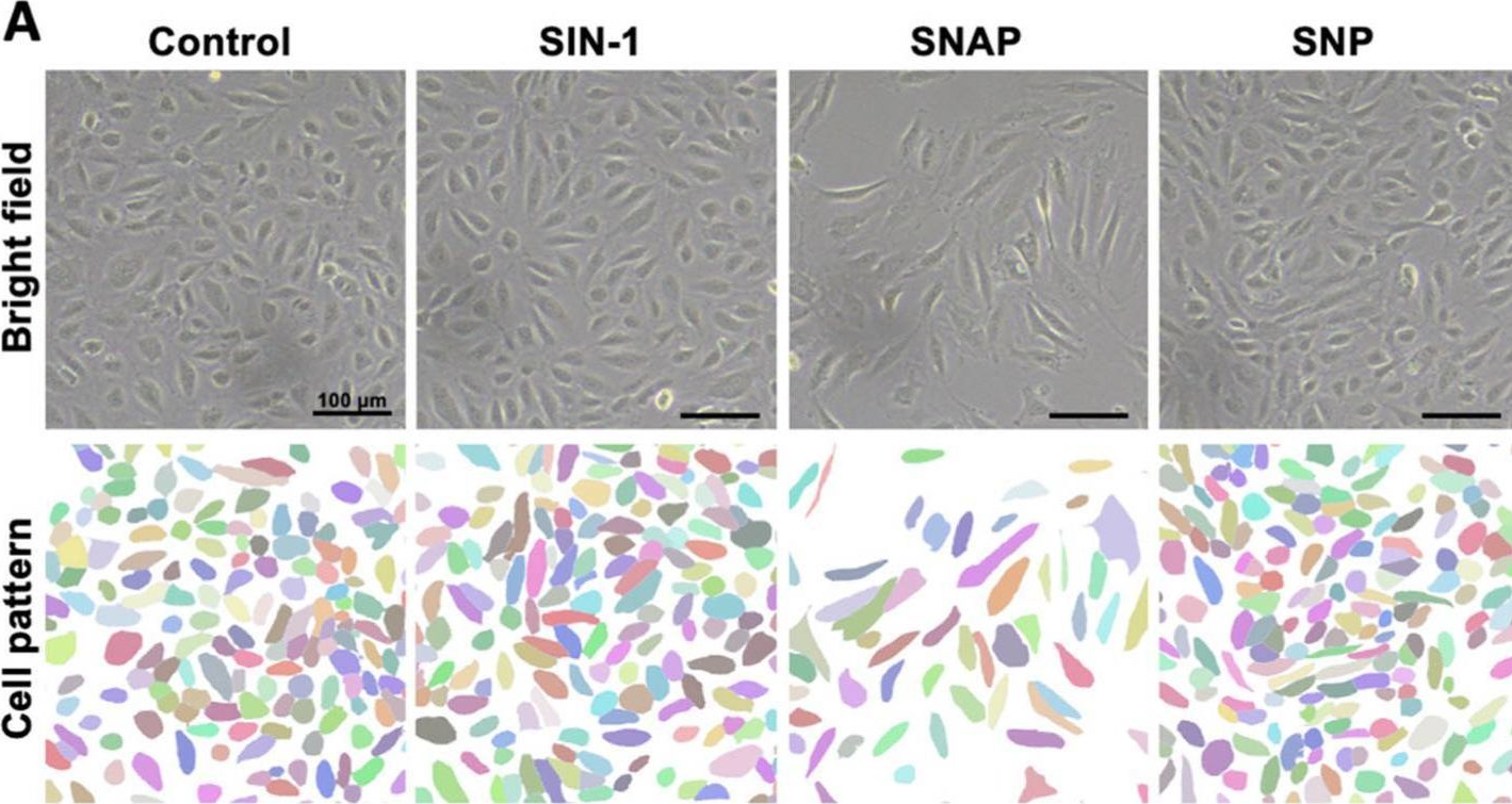 Fig.1.A from the publication: Combined Pharmacological Conditioning of Endothelial Cells for Improved Vascular Graft Endothelialization.
