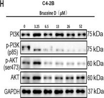 Fig.2.H showing Western Blotting from the publication: Bruceine D attenuates prostate cancer growth and motility by suppressing PI3K/AKT signaling and downregulating CXCL16: implications for skeletal metastasis in orthopedic oncology.