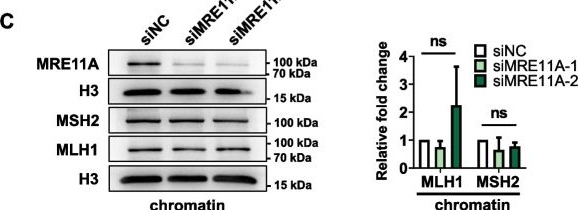 Fig.4.C showing Western Blotting from the publication: MRE11A: a novel negative regulator of human DNA mismatch repair.