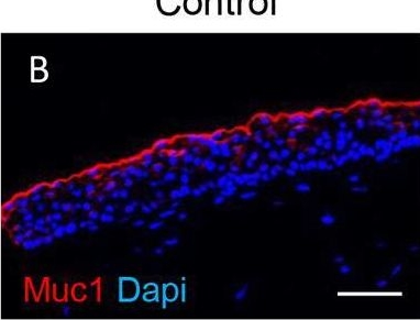 Fig.4.B showing Immunohistochemistry-immunofluorescence in a Homo sapiens (Human) sample from the publication: Contribution of Streptococcus pseudopneumoniae and Streptococcus salivarius to vocal fold mucosal integrity and function.