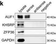 Fig.3.K showing Western Blotting from the publication: Targeting lncRNA DDIT4-AS1 Sensitizes Triple Negative Breast Cancer to Chemotherapy via Suppressing of Autophagy.