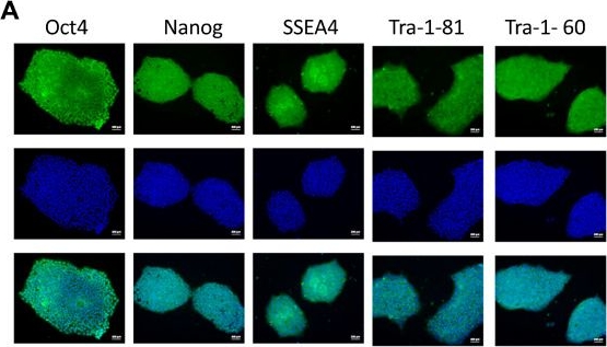 Fig.1.A showing Immunocytochemistry-immunofluorescence from the publication: A Comparative Analysis of iPSC, MSC, and 293T-Derived Exosomes for Parkinson's Disease Therapy.
