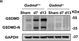 Fig.1.H showing Western Blotting in a Mus musculus (House mouse) sample from the publication: GSDMD-dependent neutrophil extracellular traps promote macrophage-to-myofibroblast transition and renal fibrosis in obstructive nephropathy.