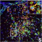 Fig.7.S showing Immunocytochemistry-immunofluorescence in a Mus musculus (House mouse) sample from the publication: IFN-gamma signaling in the central nervous system controls the course of experimental autoimmune encephalomyelitis independently of the localization and composition of inflammatory foci.