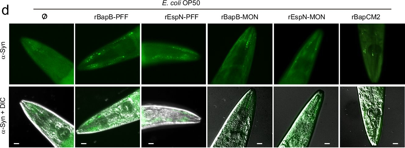 Fig.4.D showing Immunocytochemistry-immunofluorescence in a Homo sapiens (Human) sample from the publication: Gut microbiota produces biofilm-associated amyloids with potential for neurodegeneration.