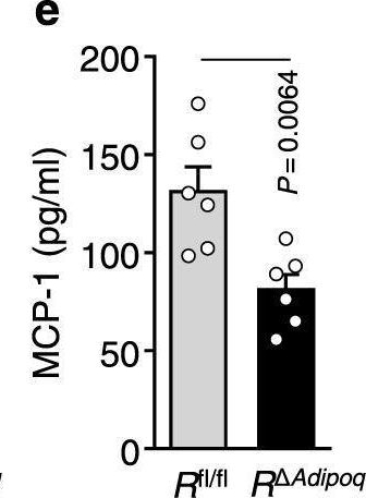 Fig.3.E showing Enzyme-linked immunosorbent assay from the publication: REDD1 promotes obesity-induced metabolic dysfunction via atypical NF-κB activation.