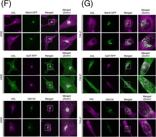 Fig.2.F showing Immunocytochemistry-immunofluorescence in a Homo sapiens (Human) sample from the publication: AXL receptor tyrosine kinase regulates Golgi organization and function via an adhesion-Arf1 signalling axis in breast and lung cancer cell lines.