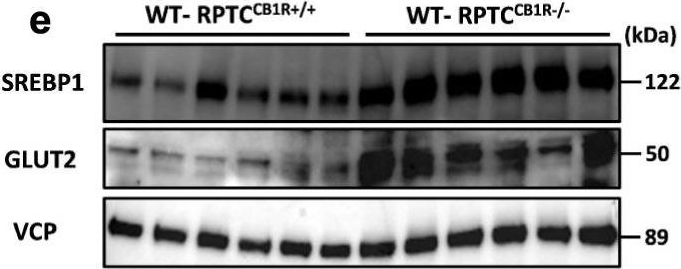 Fig.5.E showing Western Blotting in a Mus musculus (House mouse) sample from the publication: Opposite physiological and pathological mTORC1-mediated roles of the CB1 receptor in regulating renal tubular function.